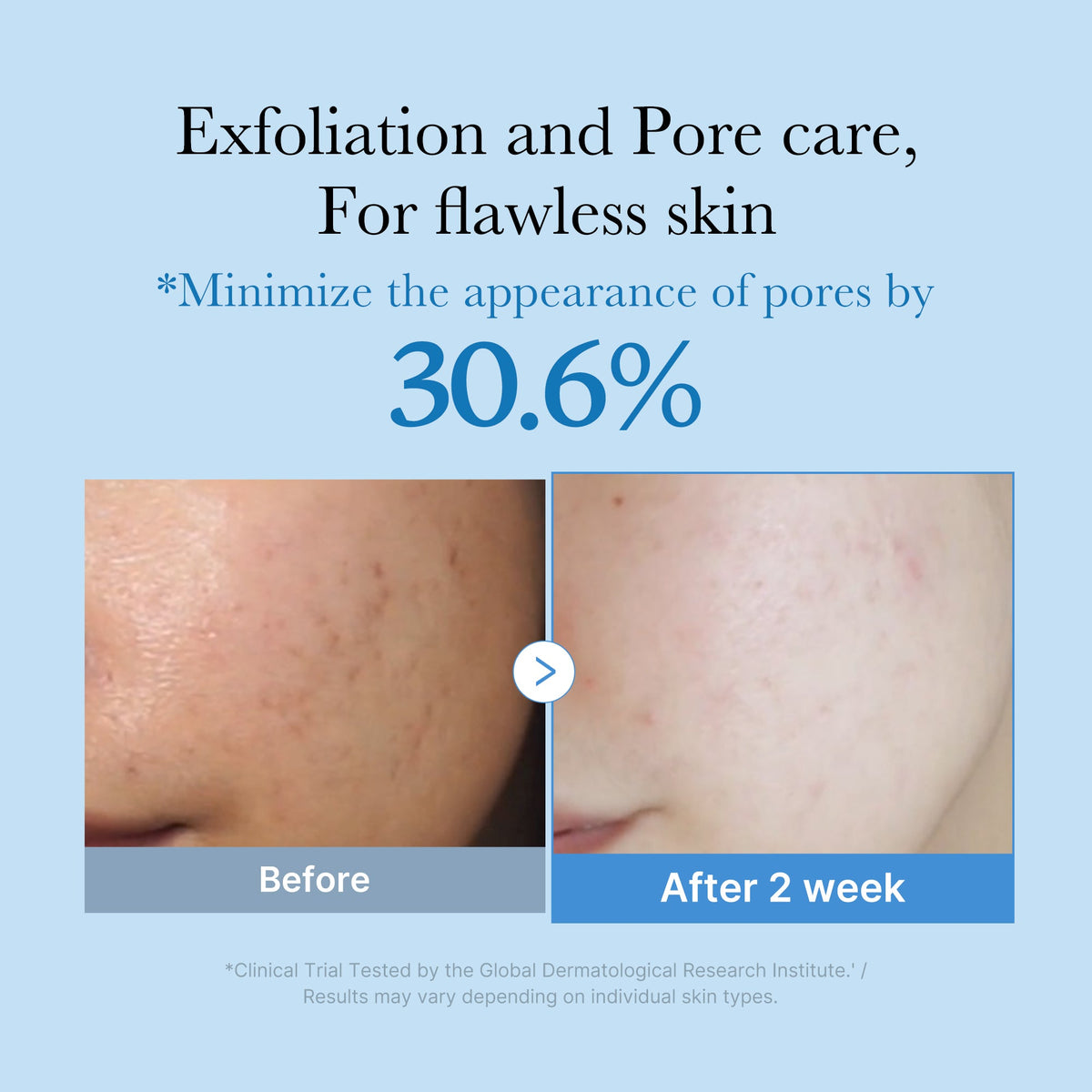 Zero Pore Toner M5
