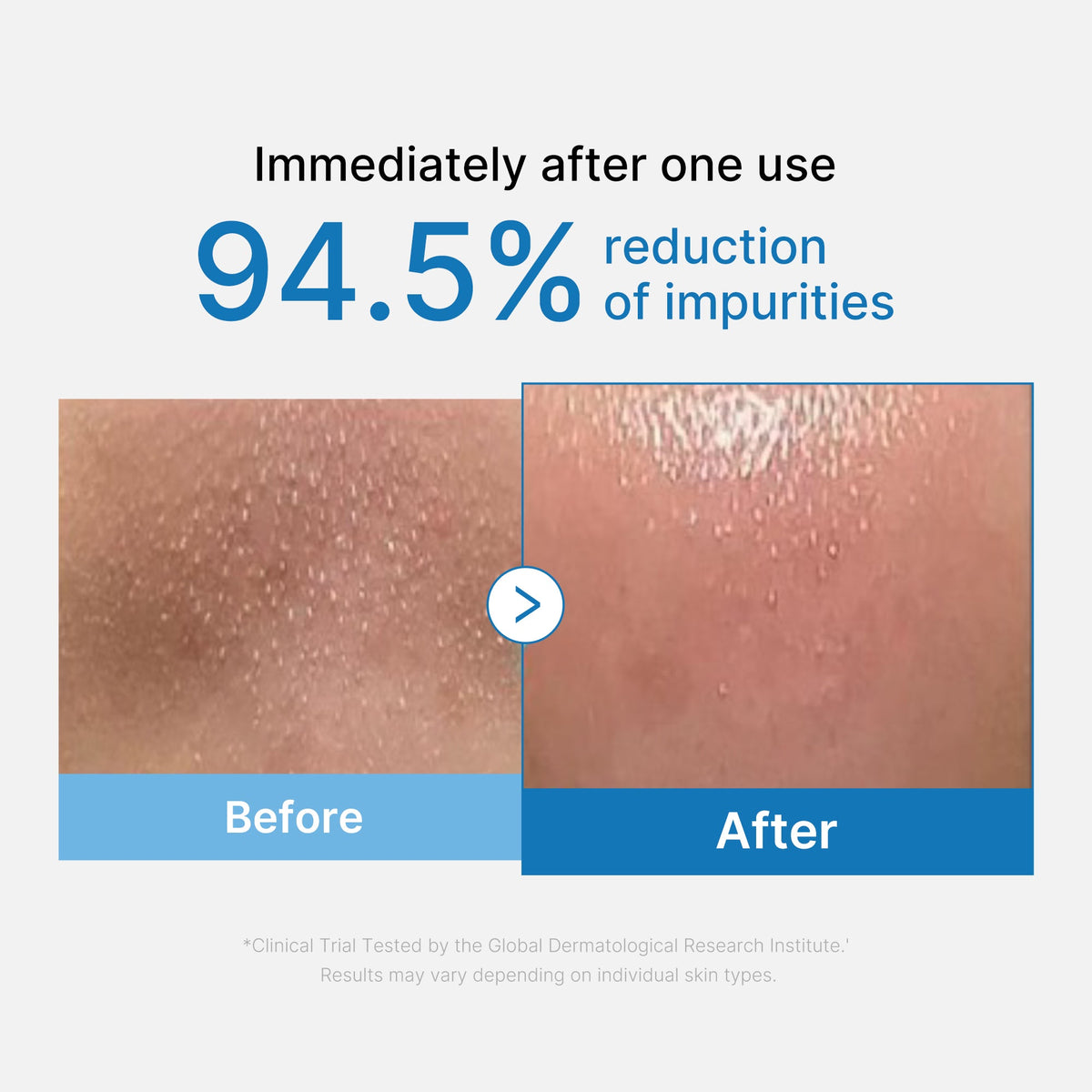 Zero Pore Blackhead Deep Cleansing Oil D3