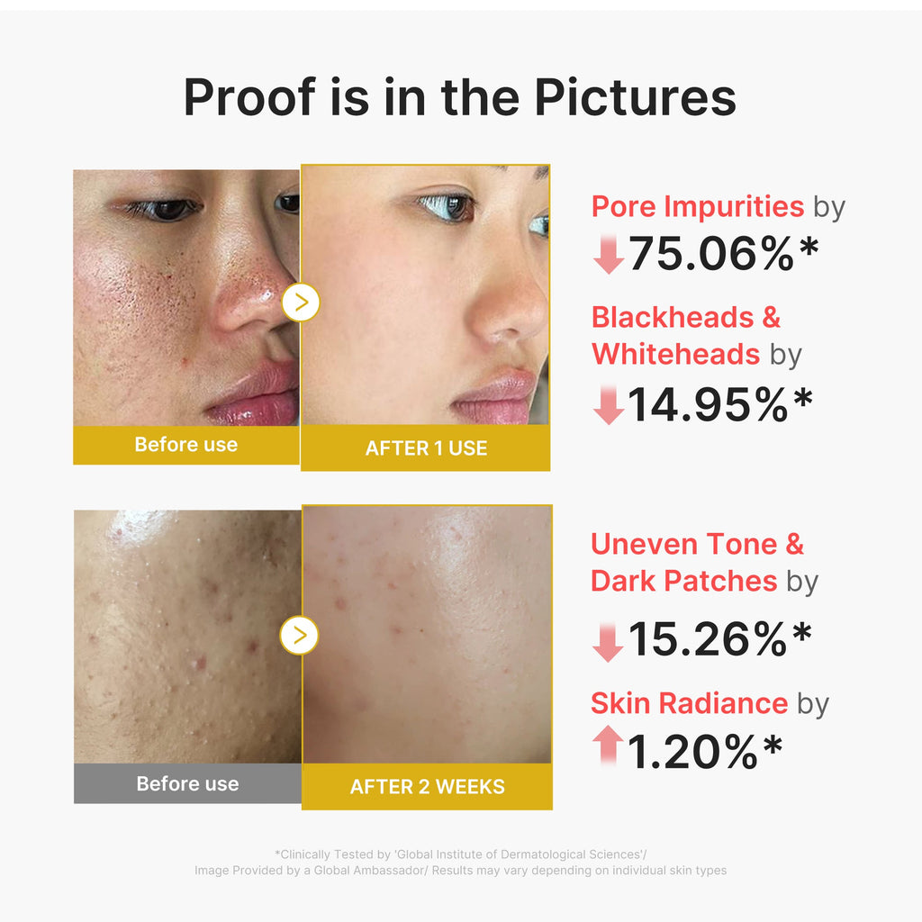 Kojic Acid Turmeric Peel Shot F4