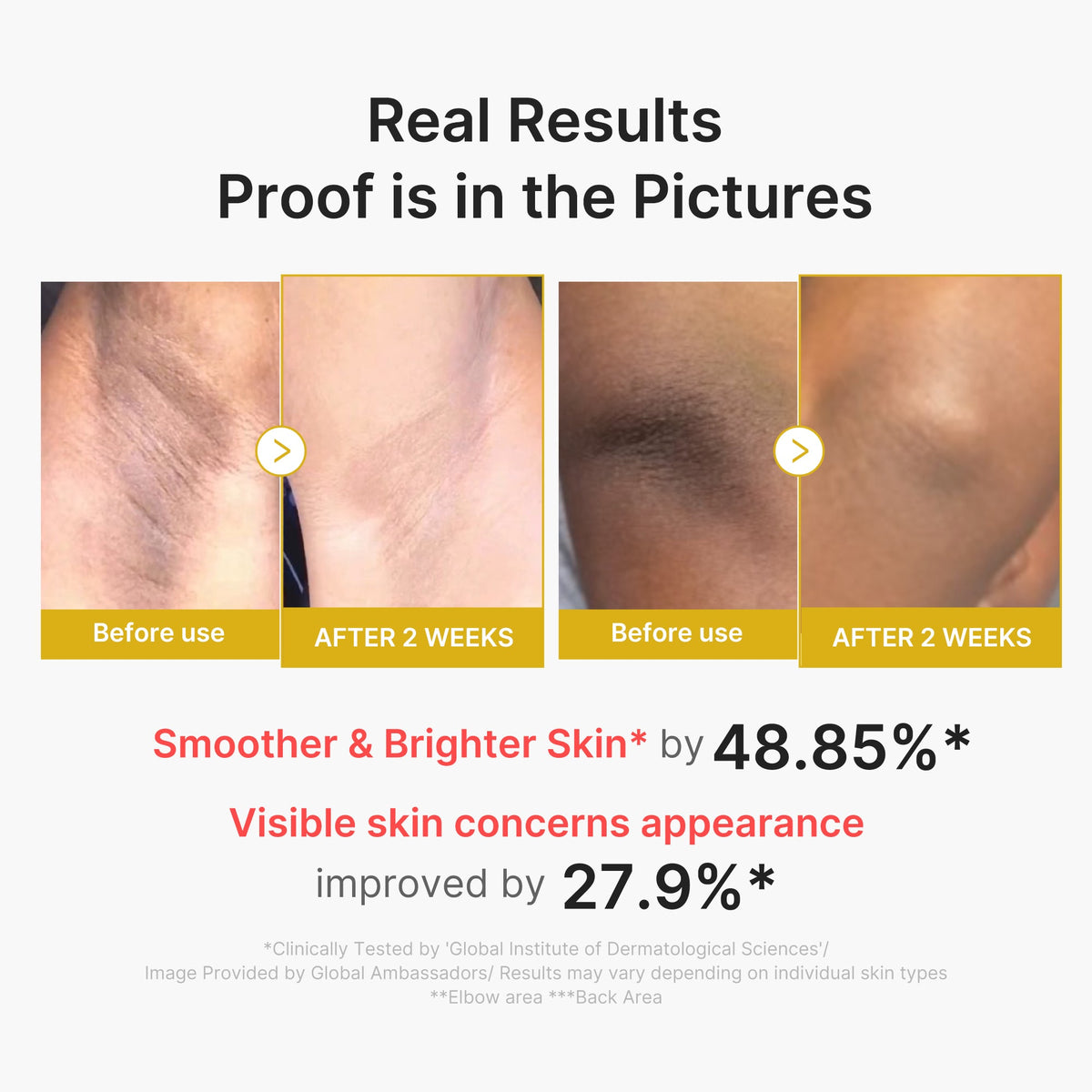Kojic Acid Turmeric Body Peel Shot R5