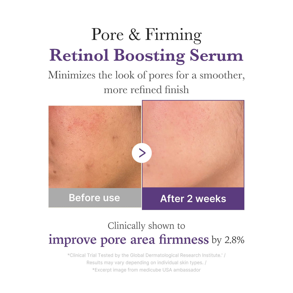 Retinol NMN Boosting Serum W5
