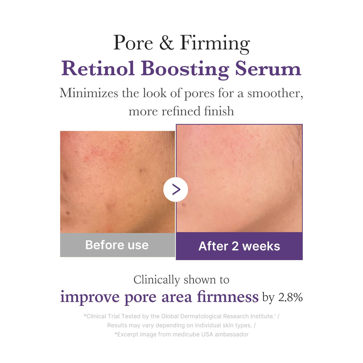 Retinol NMN Boosting Serum W5