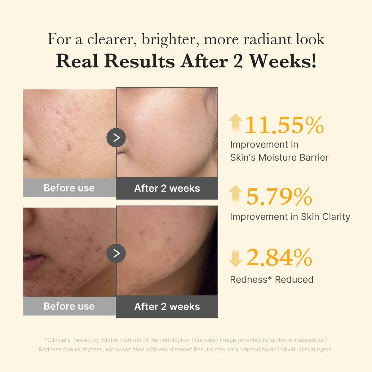 Kojic Acid Turmeric Capsule Serum O6