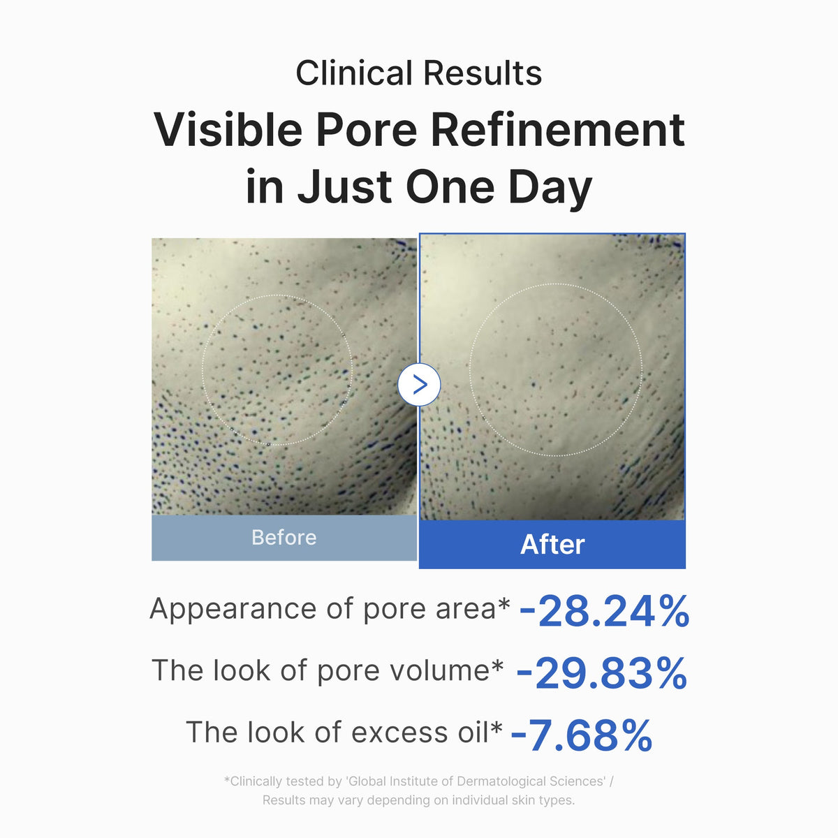 Zero Pore One-day Peptide Serum I9