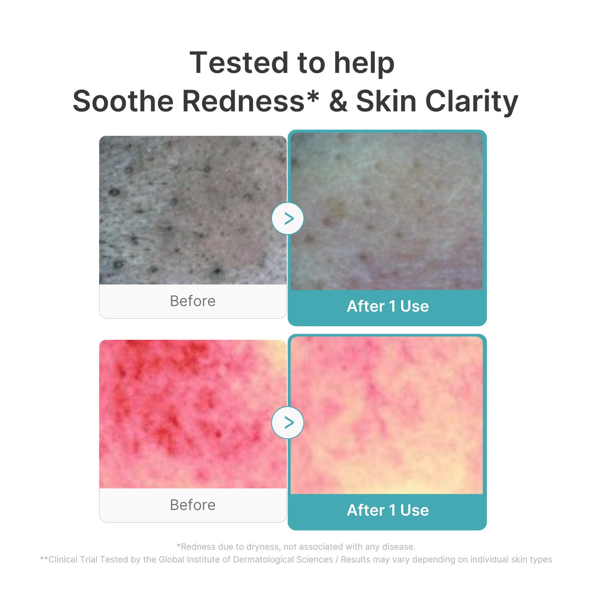 Azelaic Acid Capsule Foam Cleanser J5