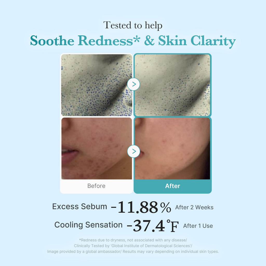 Azelaic Acid Niacinamide Clarifying Toner M9