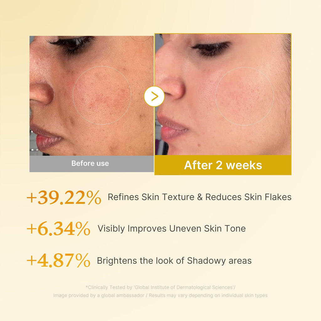 Kojic Acid Turmeric Toner I6