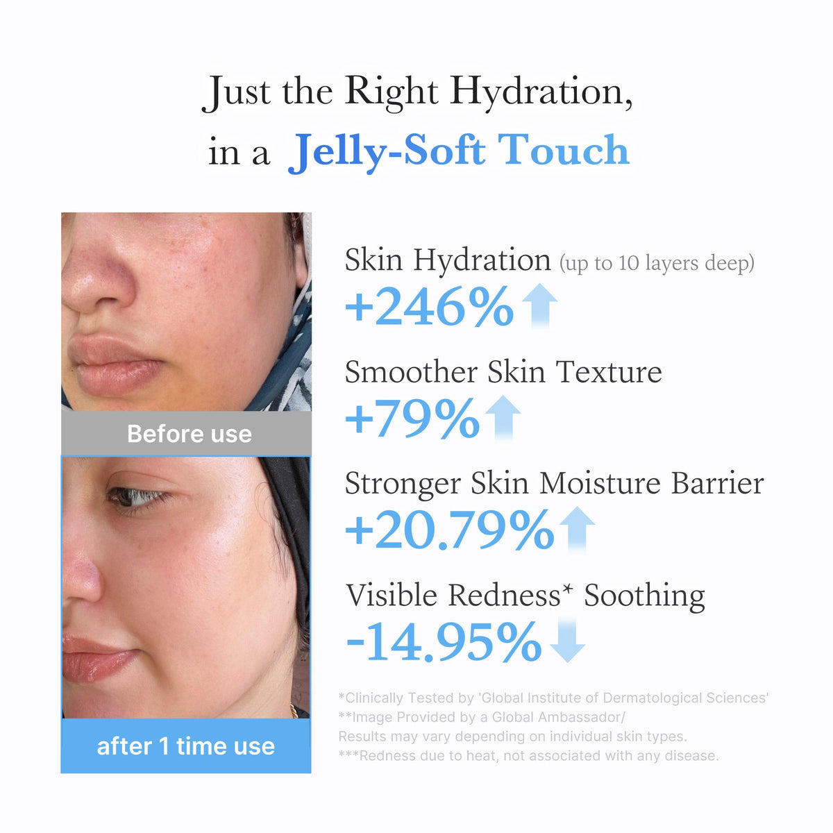 Hyaluronic Ceramide Moisturizing Jelly Cream R7
