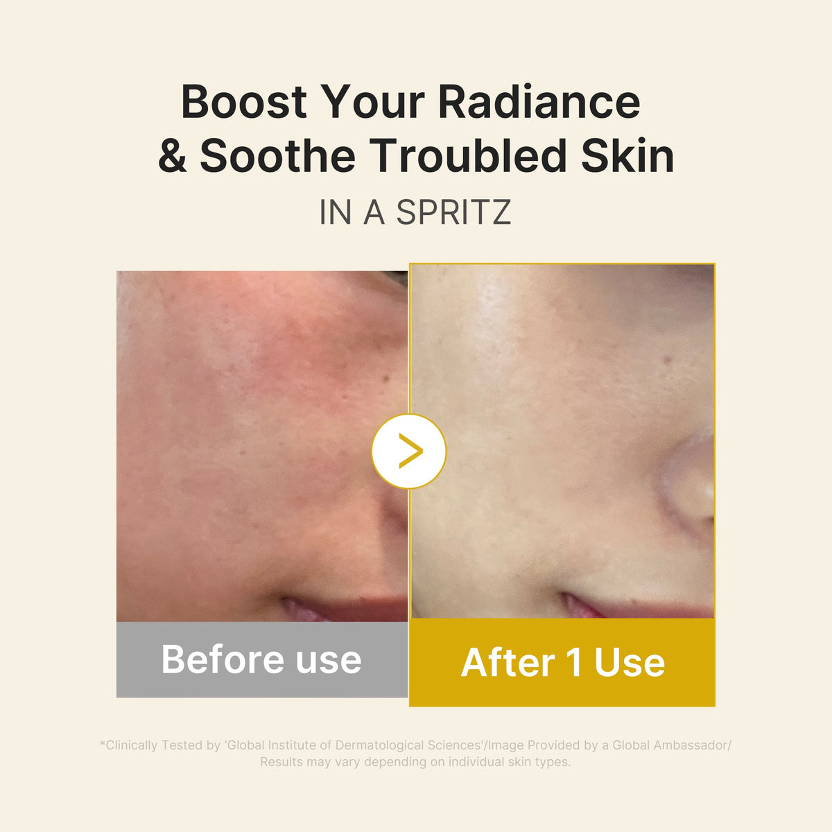Kojic Acid Turmeric Vitamin Gold Jelly Mist Serum S8
