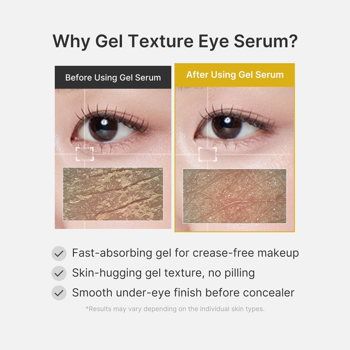 Kojic Acid Tumeric Eye Gel Serum B2