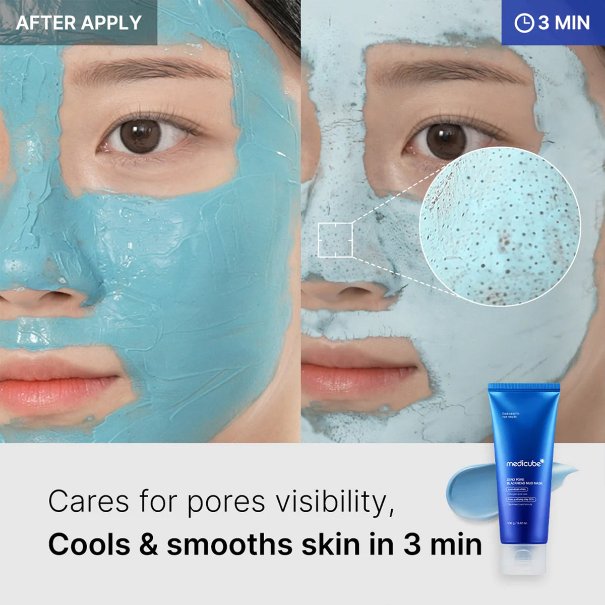 Zero Pore Blackhead Mud Mask U4