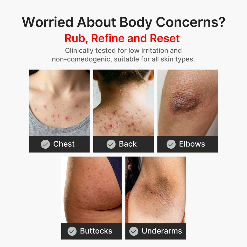 Kojic Acid Turmeric Body Peel Shot R5