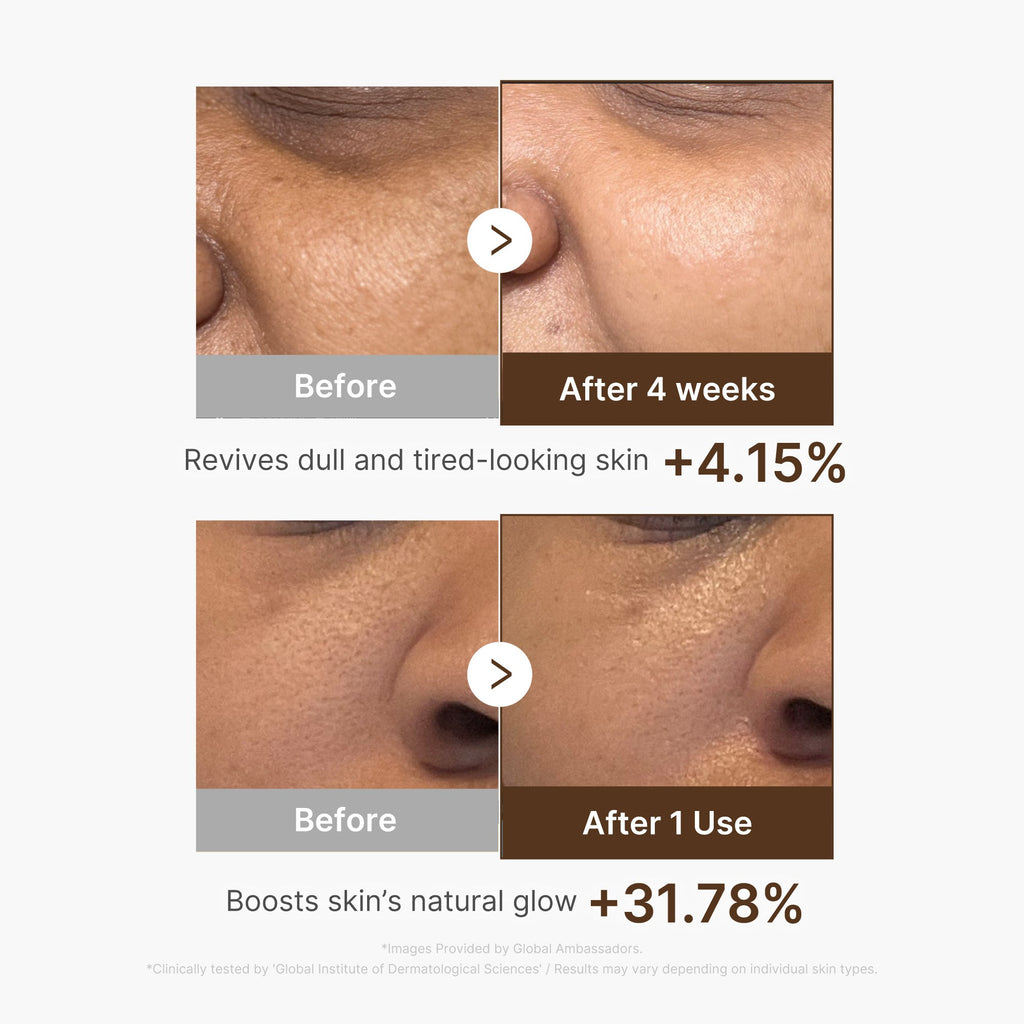 Deep Vitamin C Capsule Serum M9