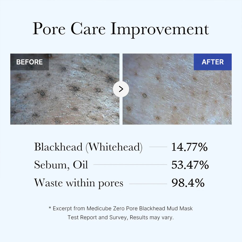 Zero Pore Blackhead Mud Mask U4