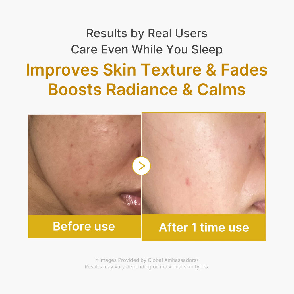 Kojic Acid Turmeric Overnight Wrapping Mask F7