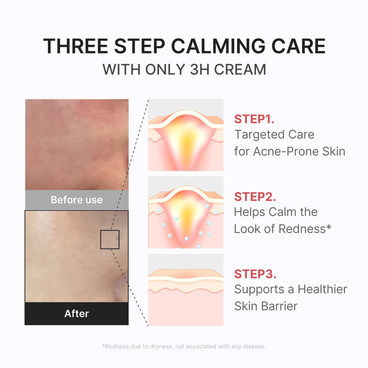 3H Daily Relief Cream H1