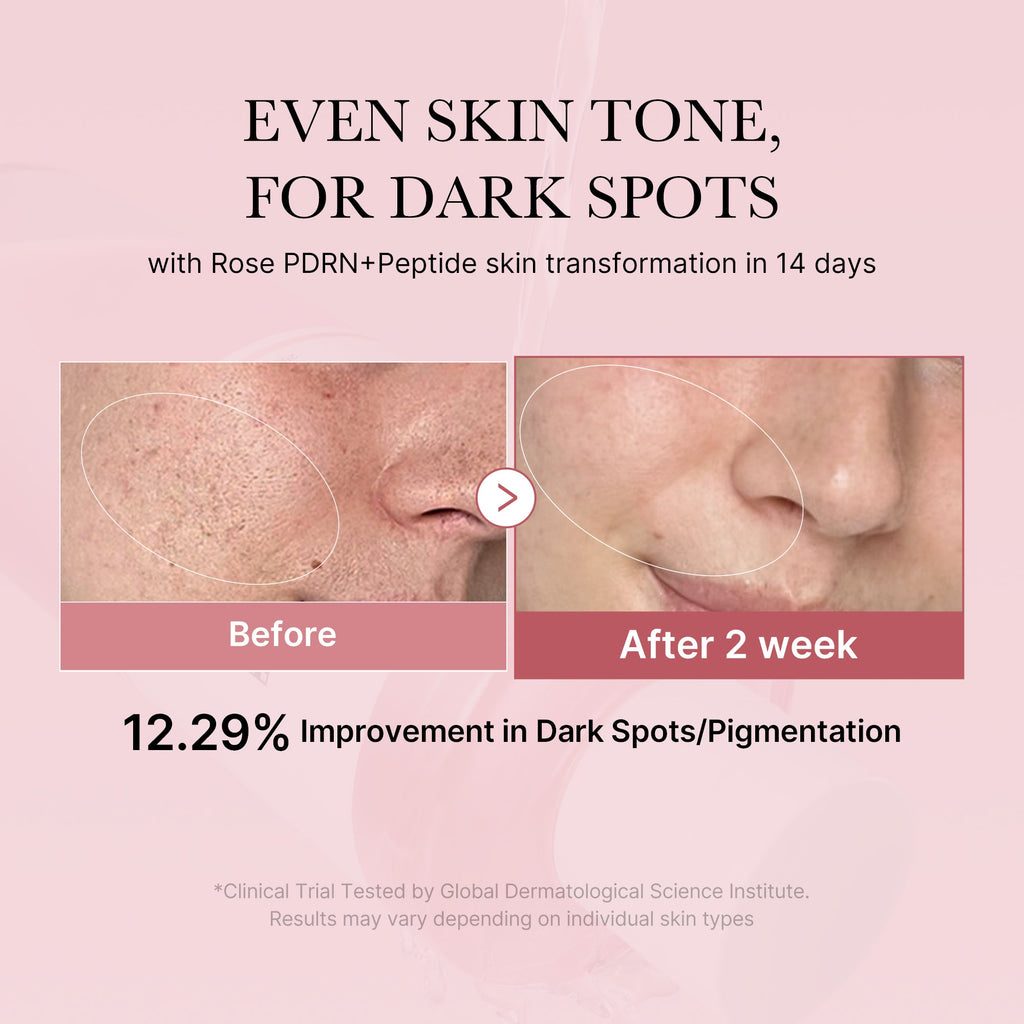 PDRN Pink Peptide Toner Z1
