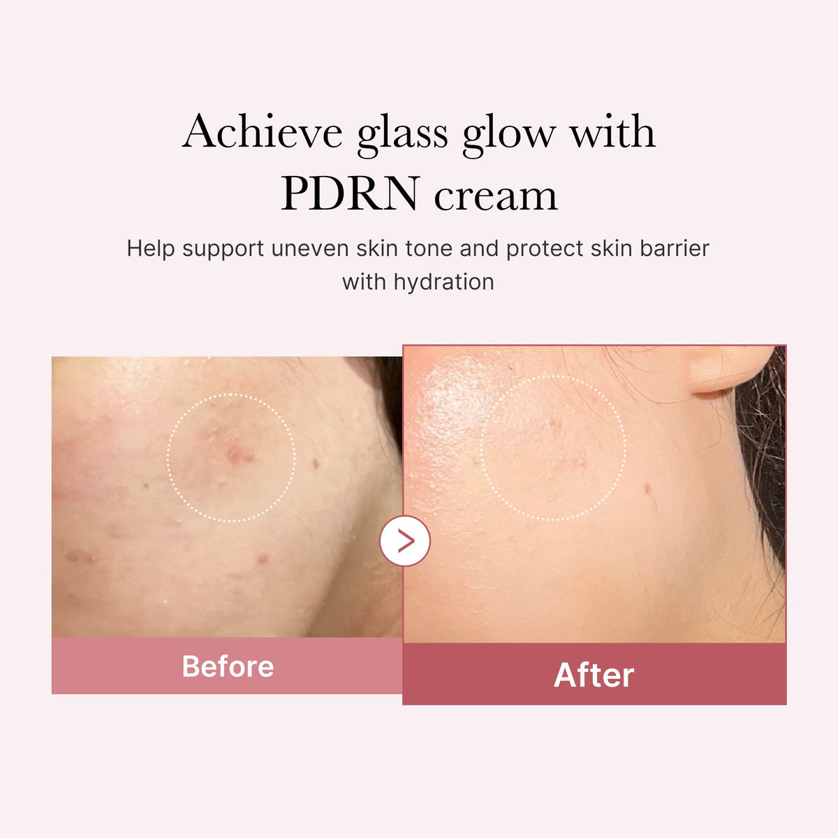 PDRN Pink Peptide Cream K3