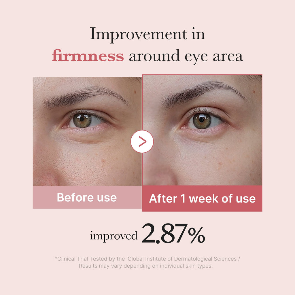 PDRN Pink Peptide Eye Cream P2