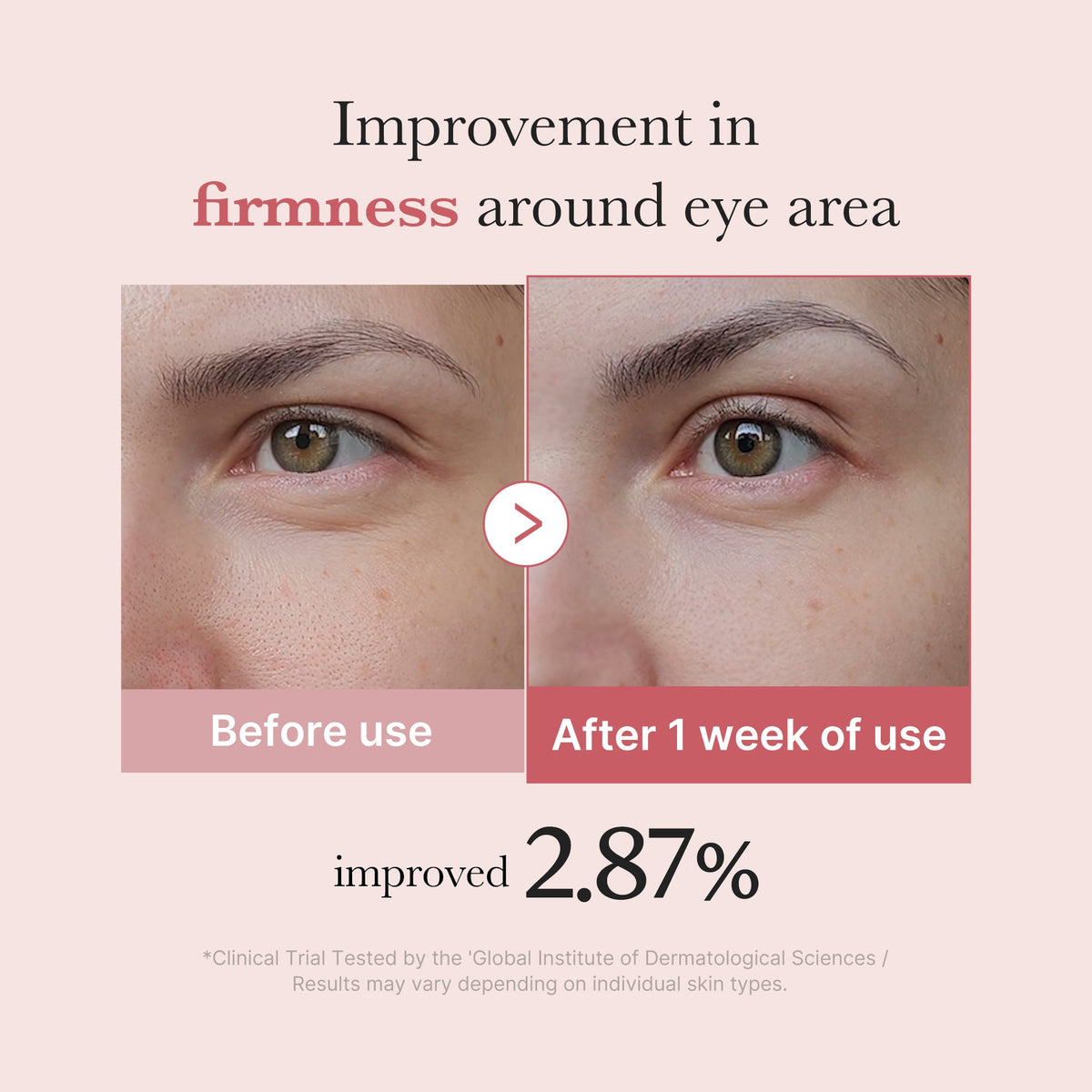 PDRN Pink Peptide Eye Cream P2