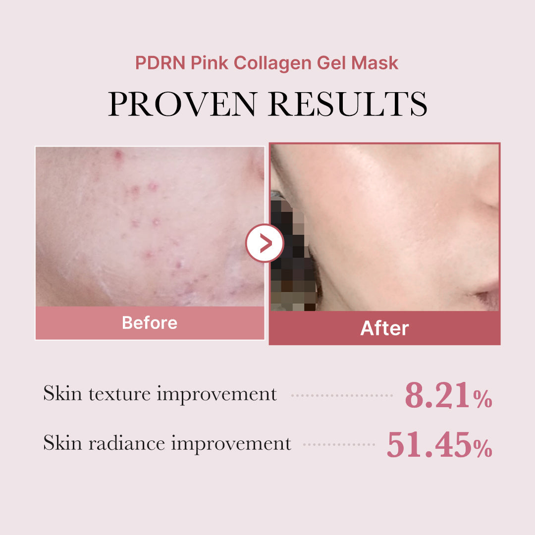 PDRN Pink Glow Full Set A9