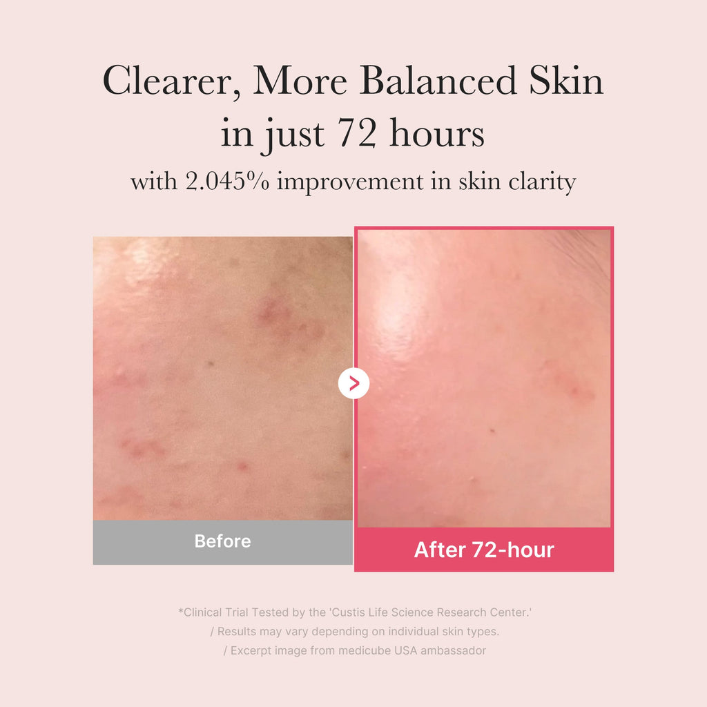 TXA Niacinamide Serum J1