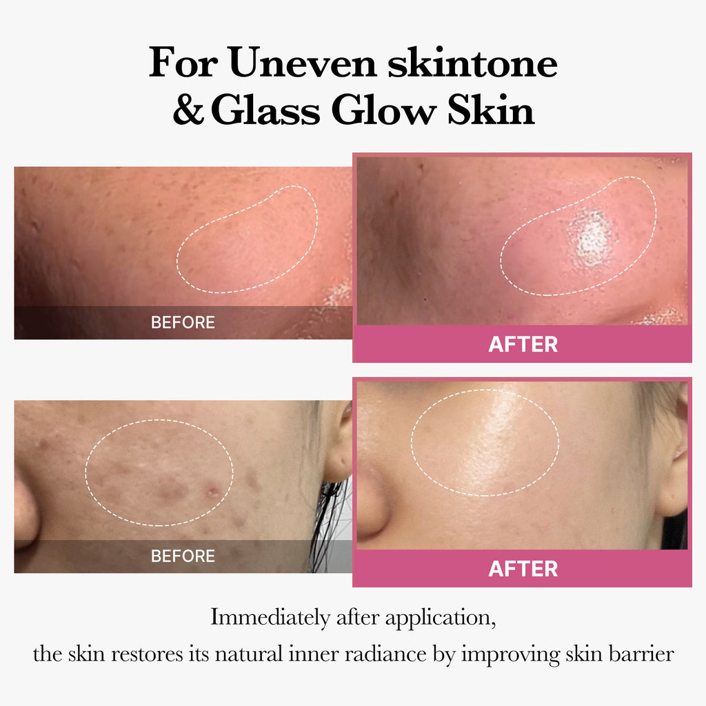 [Tati's Exclusive] All About Glow Set X8